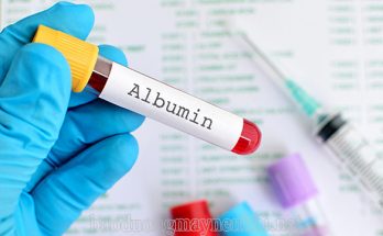 Xét nghiệm định lượng Albumin máu